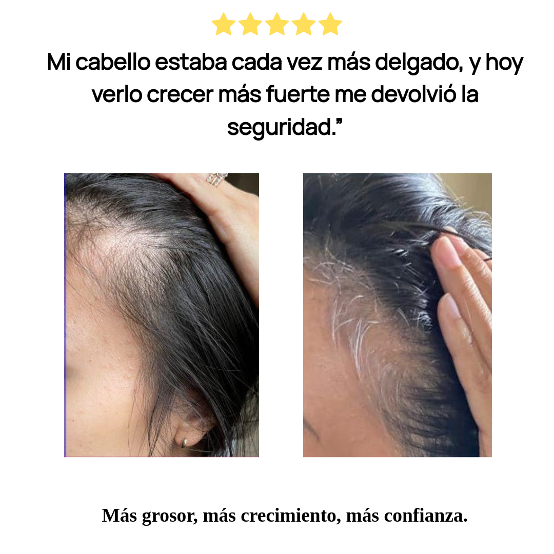 Elurea™ Tratamiento Anticaída Hormonal + Crecimiento